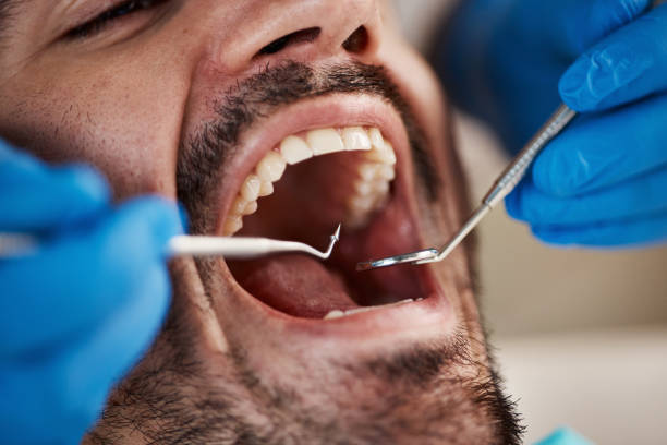 Best Emergency Dental Care for Trauma or Injury in Midland Park, NJ