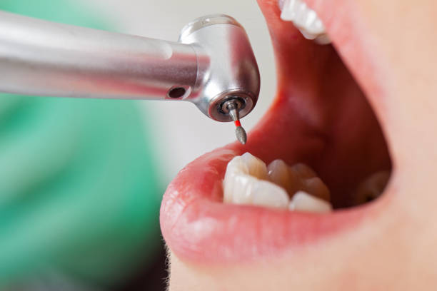 Best Emergency Broken Tooth Repair in Midland Park, NJ